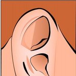 [가가] 귓볼 피지낭종 제거(<b>시원</b>함)