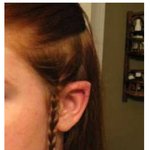 [추억파리여] 요정을 <b>소망</b>했던 사람들의 성형