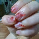 [댓글<b>절실</b>] 입술뜯는 습관 3년째.. 어떻게고쳐야할까요