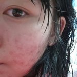 [EXO] (혐주의)아까 <b>피부고민</b>올렸는데..이게쌩얼