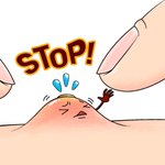 [오싹] 세상에서 가장 큰 여드름