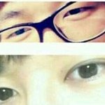 [EXO] 남자 <b>눈성형</b> 후기래