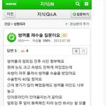 [추억파리여] <b>역대</b> 가장 안타까운 성형수술녀