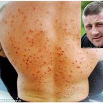 [추억파리여] 총탄 <b>파편</b> 150발 맞고도 살아난 남자