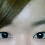 어떤<b>눈</b><b>수술</b>하면괜찮아질까요?