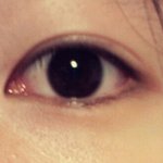 갑자기 생긴 <b>쌍</b>커풀 고민 (사진ㅇ)