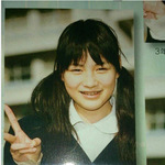 성형으로 급변한 케이스