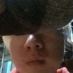 <b>양악</b> (돌려깎기) 해야겟죠?