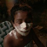 [<b>헐랭</b>] 예뻐서 난도질을 당한 여성