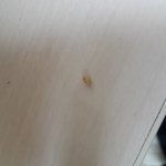 [꼭댓글부탁] 목에서 이상한게..