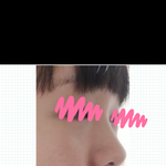 [댓글부탁] 애들이 코<b>성형</b>한것같다고 해서요ㅠㅠ 봐주세요ㅠㅠ