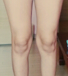[댓글부탁] 다리 좀 봐주세요