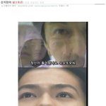 [널스토리] 기묘한 이야기 - 말기 암을 <b>치료</b>하는 방법