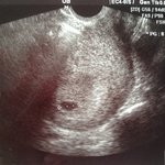 [10/26 기념] 2014년 <b>파란</b>코트녀&amp;폭풍매너남 근황