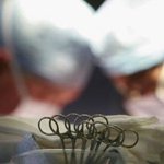 [추억파리여] 포경수술 했는데 아래가 <b>허전</b>..경악