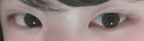 [조언부탁] 손나은처럼 <b>쌍수</b>