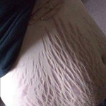 [사랑] 세상에서 가장 아름다운 <b>흉터</b>.jpg