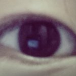 [EXO] <b>이런눈</b> 쌍수할까 vs 앞트임