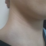 [조언부탁] 목주름 없애려면 인생<b>리셋</b> 필요한 흔녀 얘기임다ㅠ