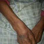 [폭행] 간병인에게 폭행당한 치매노인