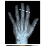 [추억파리여] 소름 끼치는 x-ray <b>사진</b>들 <b>jpg</b>