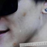 [EXO] 종대이사진볼<b>때</b>마다안쓰럽..(<b>피부</b>주의)