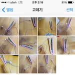 걱정병인지 불안병인지 이런분 계신가요?