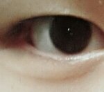 [댓글부탁] 어느눈이 더 나아요?