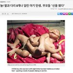 [추억파리여] 팔과 다리 8개나 달린 아기 <b>탄생</b>