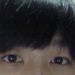 눈<b>성형</b>한 남자인데요 티가 너무 많이납니다