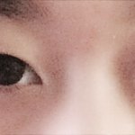 [꼭조언부탁] 쌍수 + 트임 할까요?