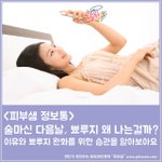 [여드름피부] 음주 다음날 뾰루지(여드름) 올라오는 이유와 완화법