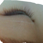 [쌍꺼풀] 자연유착으로 <b>쌍수</b>한 눈인데 <b>티</b> 나요?