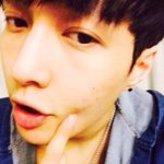 [EXO] <b>짝남</b>과 톡을하다 자기 뾰루지 났다고 