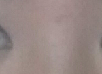 [EXO] 나 <b>앞트임</b> 해야할까?