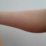 사진) 제 종아리 왜이런거죠?