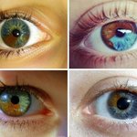 [추억파리여] 눈동자색이 여러가지 섞인 <b>홍채</b>이색증