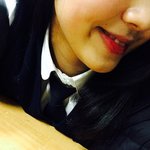[성형] 이정도면 턱 <b>양악</b>해야되나요??? 심하지않나요???