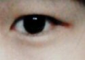 [EXO] 나눈<b>수술</b>뭐뭐해야될것같아?