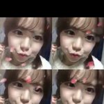 홍영기이거입꼬리<b>수술</b>한건가요?