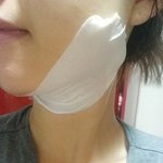 [턱살빼기] <b>턱살</b> 나도 빠질수 있을까?...하...