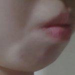 [exo] 성형후에 완전 새로 태어난거같아.믿기지않는다ㅠㅠ