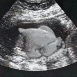 [EXO] 우리애기사진