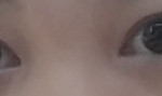 쌍수<b>티나</b>?