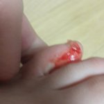 [EXO] 저기 초면에 발가락 보여줘서 미안한데