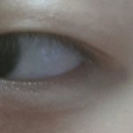 [EXO] <b>눈</b>커지는법이<b>수술</b>밖엔없는것이냐