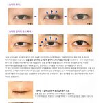 [exo] 카이 눈수술 <b>의심</b>