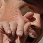 [<b>아리</b>] 두개골이 뚫린 남자