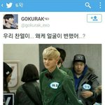 [EXO] 애들아 쌍수 <b>절개</b> 많이 아픔????