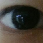 [댓글부탁] 쌍수하려는데 <b>제눈</b>어떤가요ㅠ.ㅠ..?